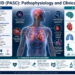 Long COVID (Post-Acute Sequelae of SARS-CoV-2): Pathophysiology, Clinical Phenotypes, and Evidence-Based Management 2026